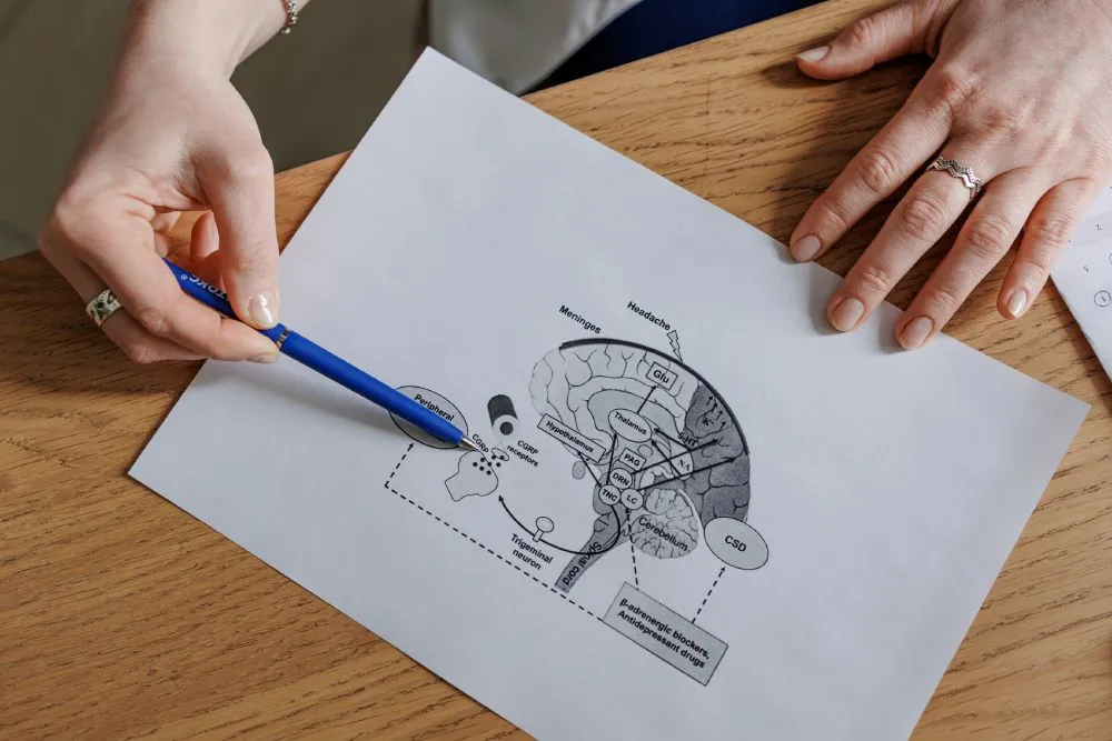 Ежедневная головная боль, обычные обезболивающие не помогают — как мы сняли зависимость от лекарств при мигрени