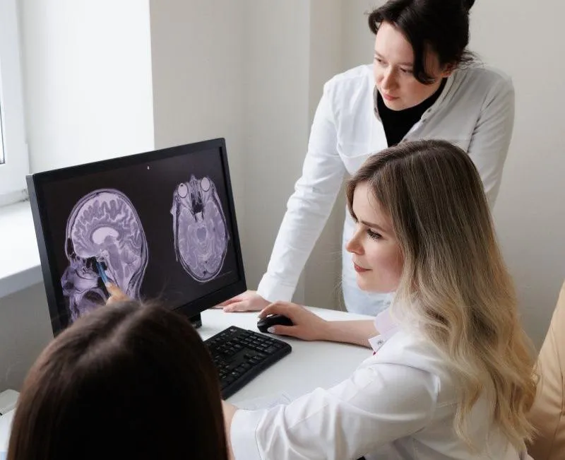 Лечение мигрени препаратом «Кьюлипта» (Qulipta)